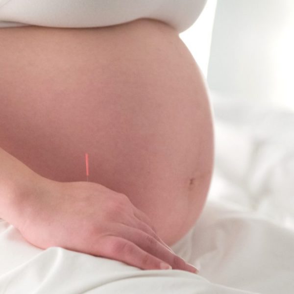 Pregnancy Acupuncture 1080x675 1