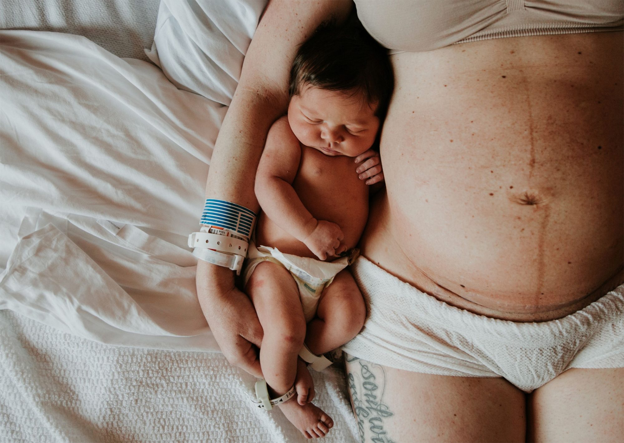 Acupuncture and Post-Partum care 1 Life after birth