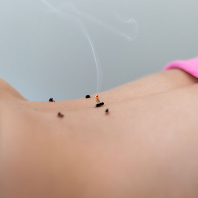 Gold Coast Acupuncture, Myotherapy, Massage & Naturopathy